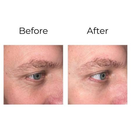Peptilux – Anti-Falten Augencreme „Shock Action“-Effekt mit LIPHASYN