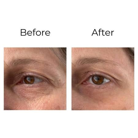 Peptilux – Anti-Falten Augencreme „Shock Action“-Effekt mit LIPHASYN