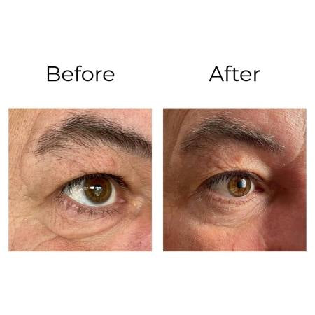 Peptilux – Anti-Falten Augencreme „Shock Action“-Effekt mit LIPHASYN